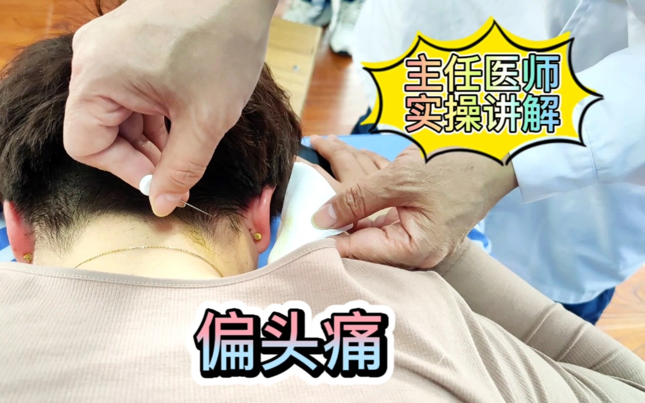 病案分享:头晕头痛原因分析,偏头痛如何治疗?针刀松解风池穴!