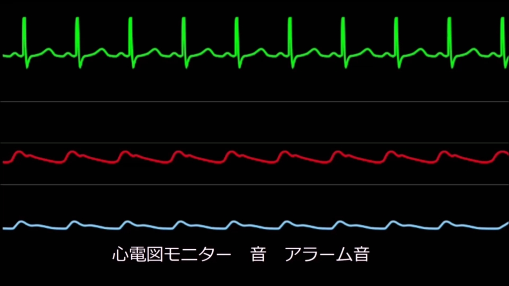 日本光电心电监护仪的三种提示音哔哩哔哩bilibili