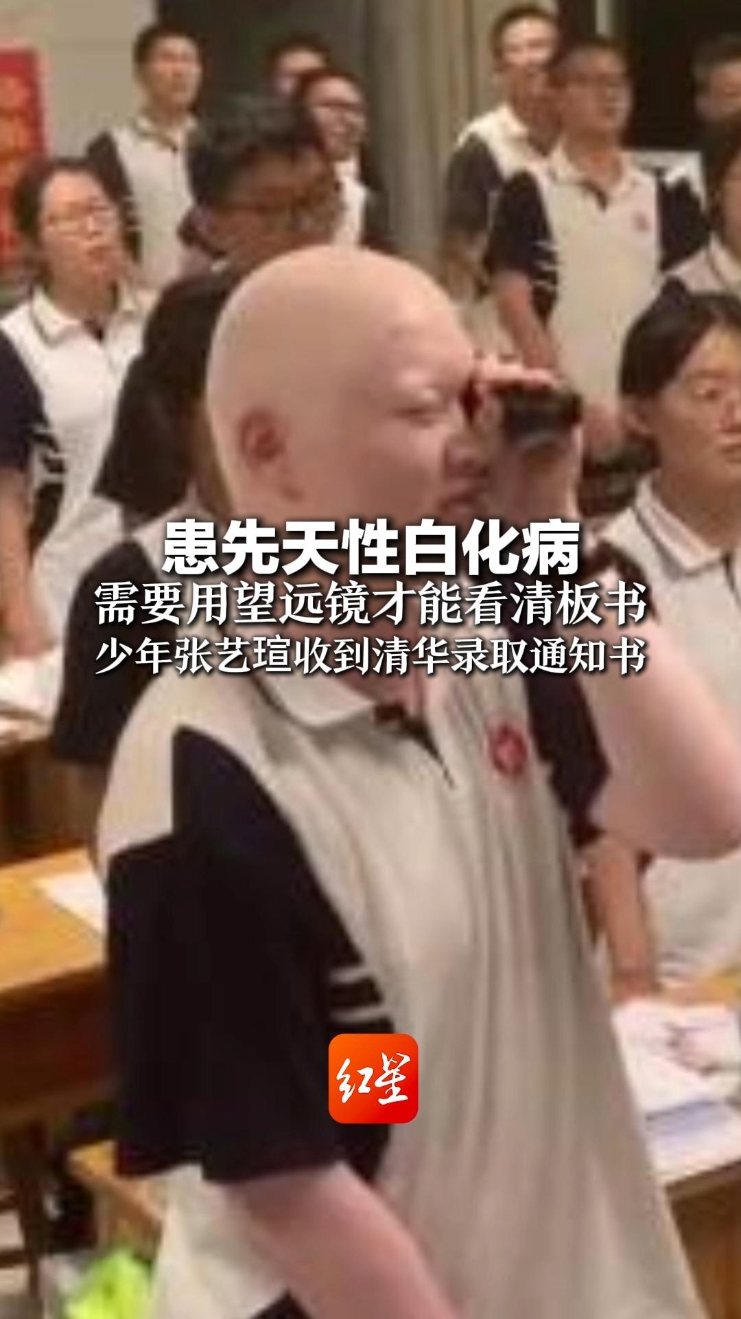 患先天性白化病,需要用望远镜才能看清板书,少年张艺瑄收到清华大学