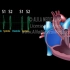 （中文字幕）动画解释健康心音和心脏杂音的形成原理