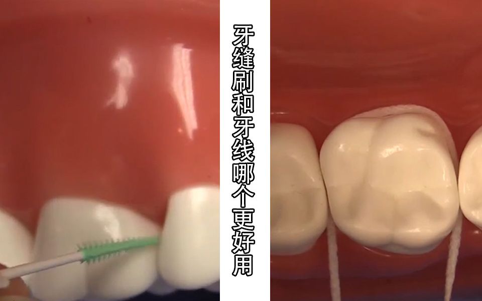 牙缝刷vs牙线你会怎么选?