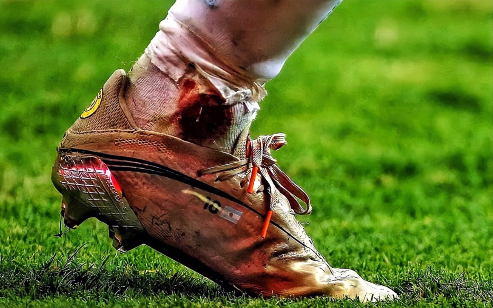 足球梅西用血腥的脚踝摧毁了哥伦比亚