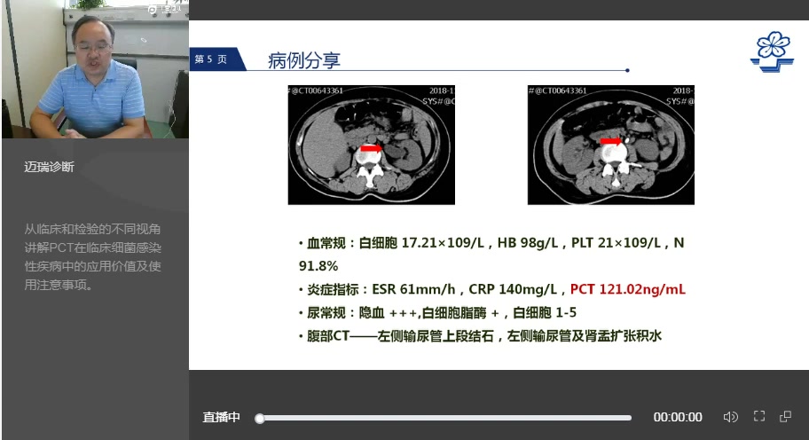 [图]PCT在临床应用中价值解析