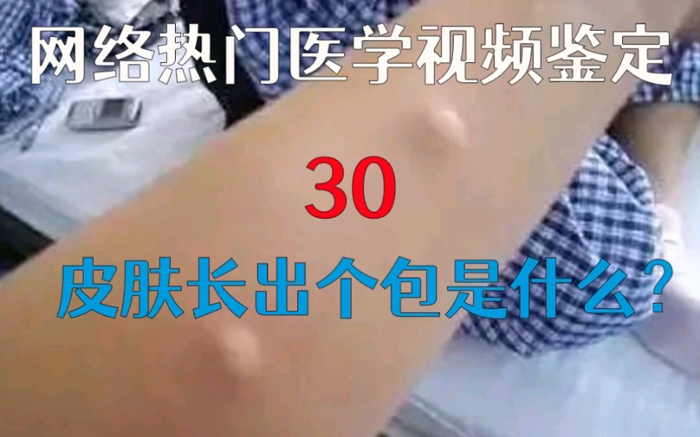 [图]【医学鉴定30】皮肤长个大包是怎么回事？