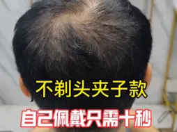 Video herunterladen: 夹子款适合头发稀少人群，不用剃头顶还是比较方便的！