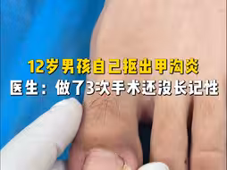 12岁男孩自己抠出甲沟炎 医生：做了3次手术还没长记性