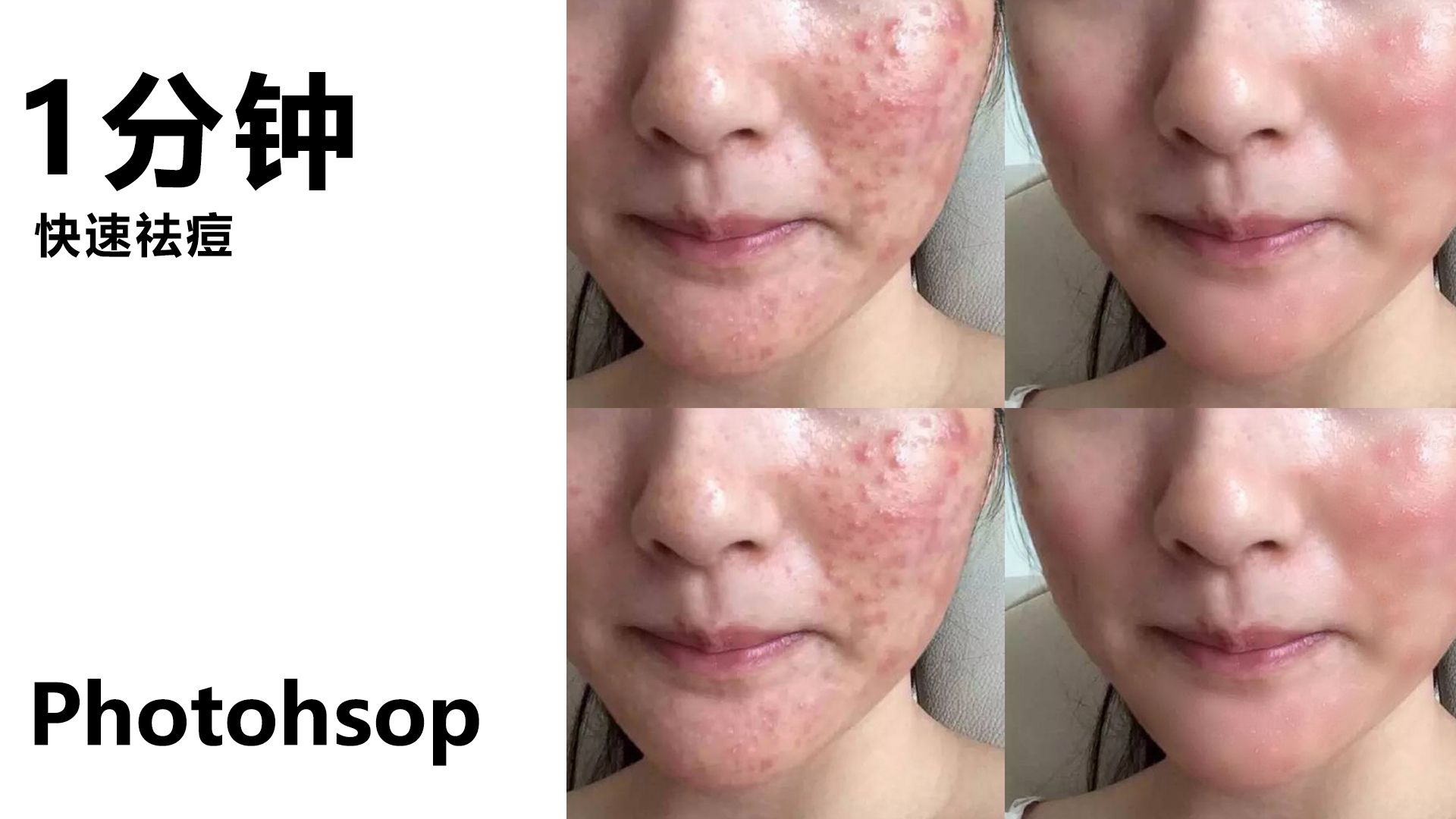 使用photoshop一分钟给人物快速祛痘