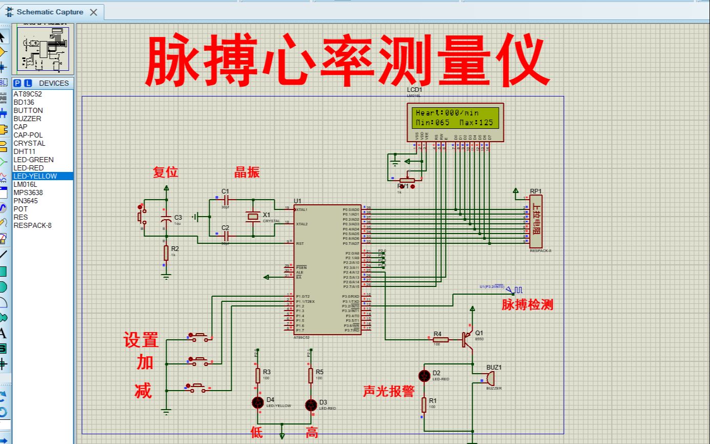 【全套资料.zip】基于单片机脉搏心率测量系统【proteus仿真+程序+报告】哔哩哔哩bilibili