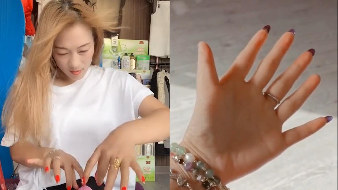 安徽一女子天生12根手指自嘲六指琴魔,网友:抓痒痒能多挠一道