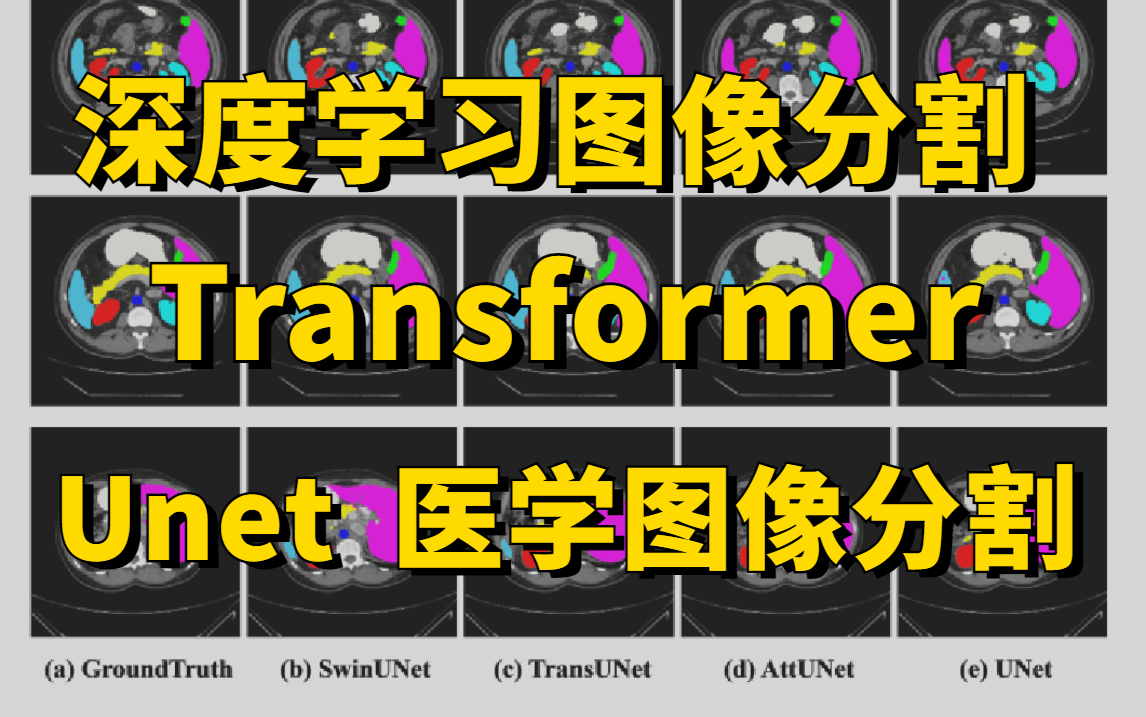 究极简单!全网最全深度学习图像分割教程!Transformer医学图像分割|Unet|语义分割|deeplab一个视频带你搞懂!哔哩哔哩bilibili