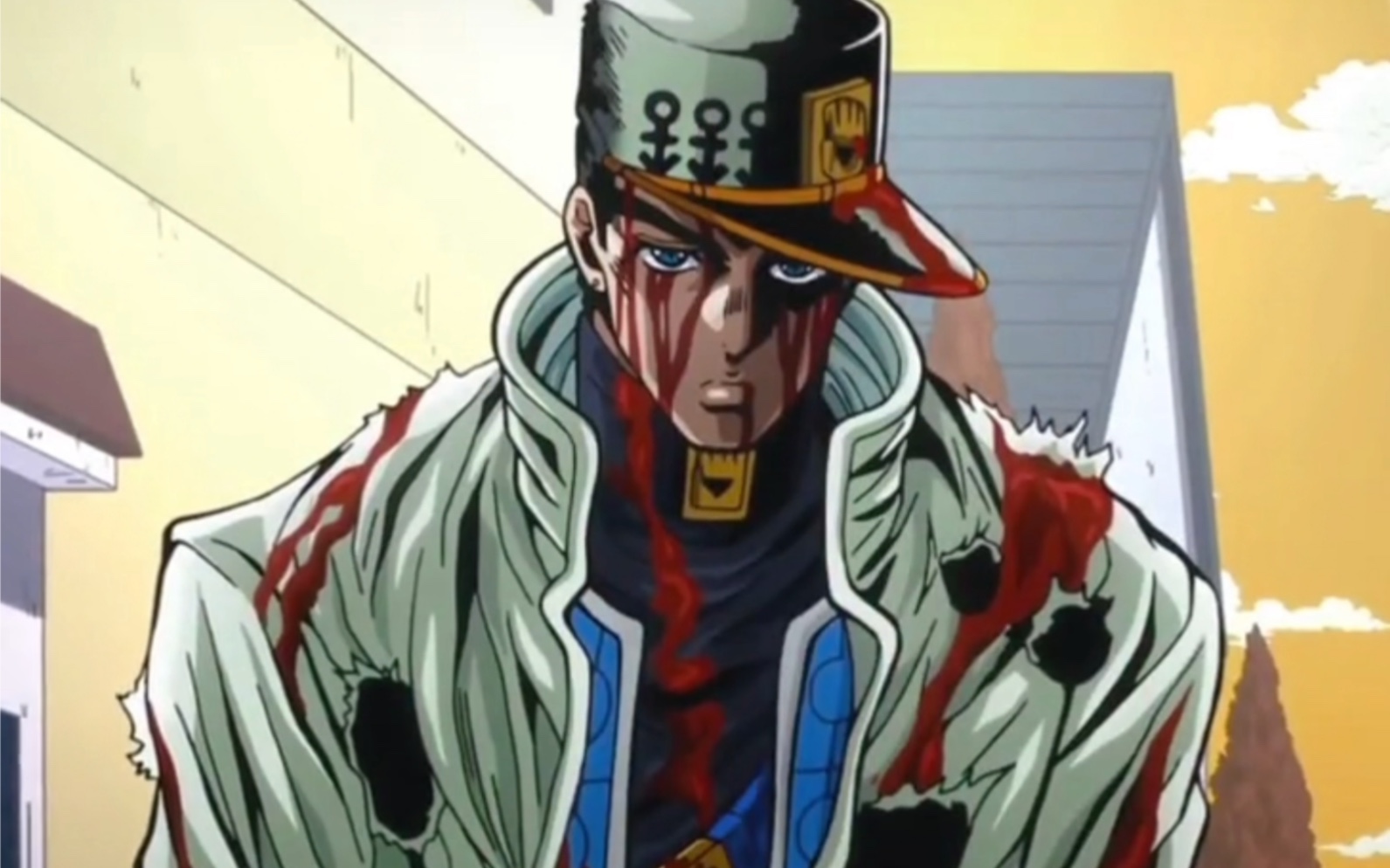 "承太郎受伤了关我白金之星什么事啊"