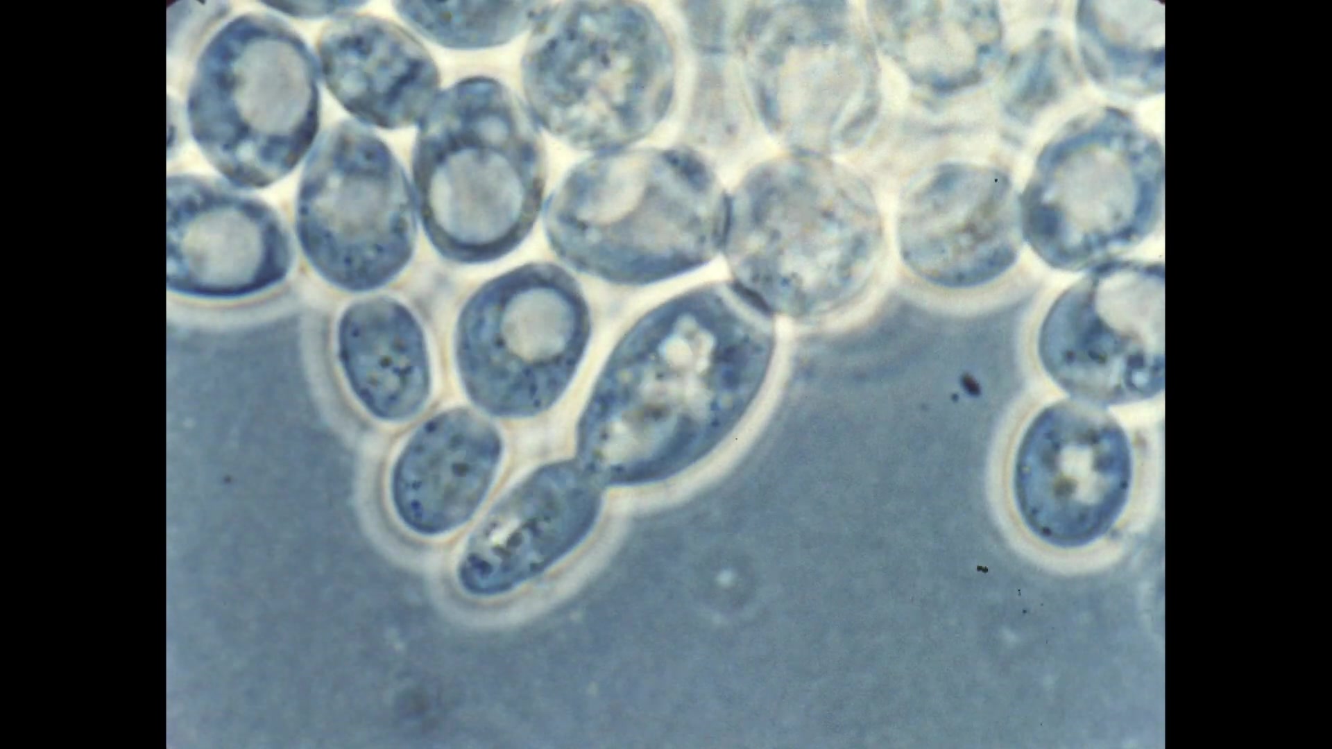 酵母出芽生殖图片