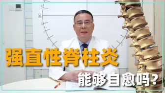 Télécharger la video: 强直性脊柱炎能够自愈是真的吗？