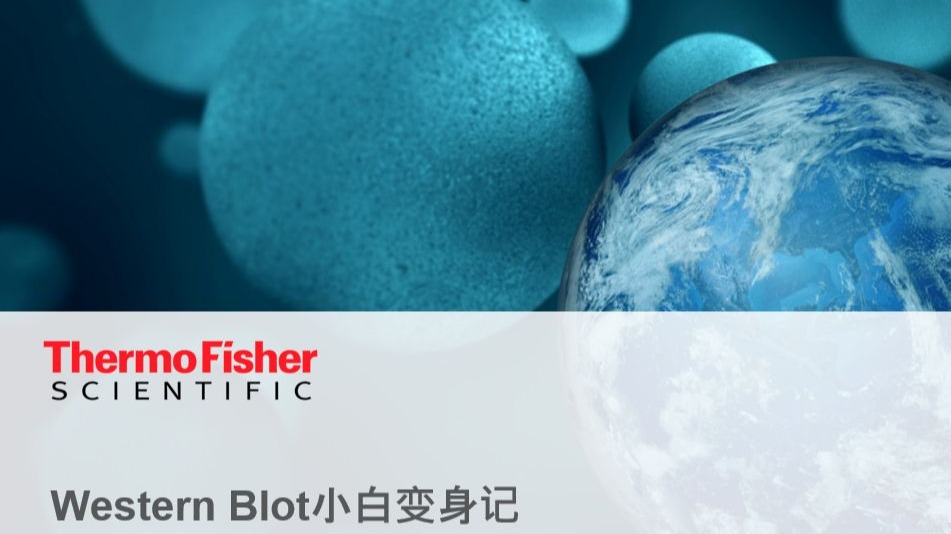 Western Blot小白变身记 - Western Blot基础技术原理及常见问题解答