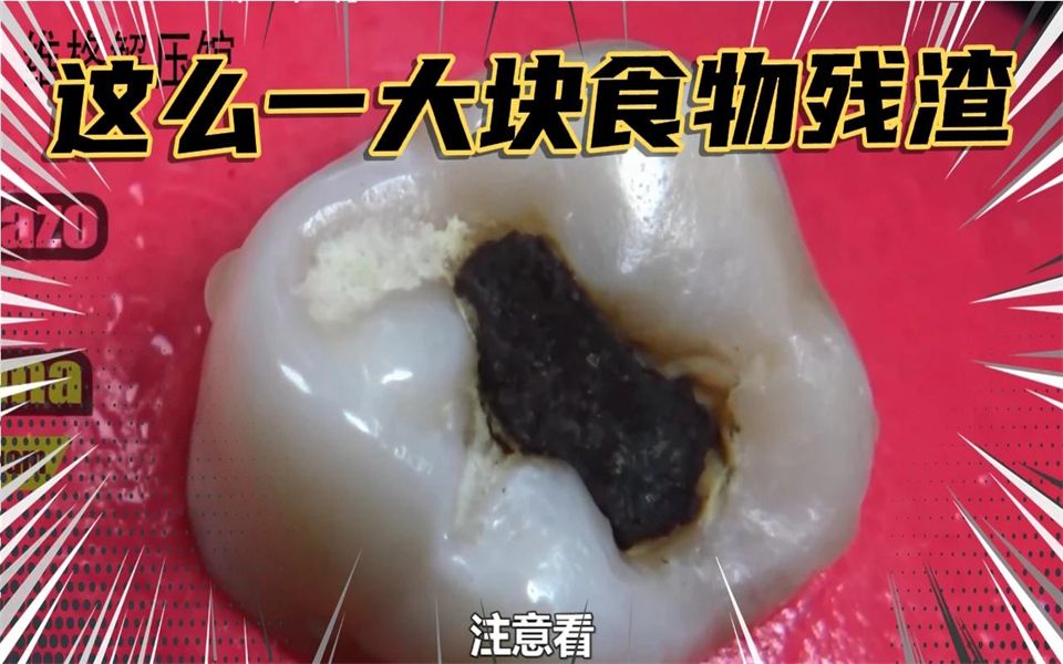 这个人的牙齿上竟然有这么大一块食物残渣