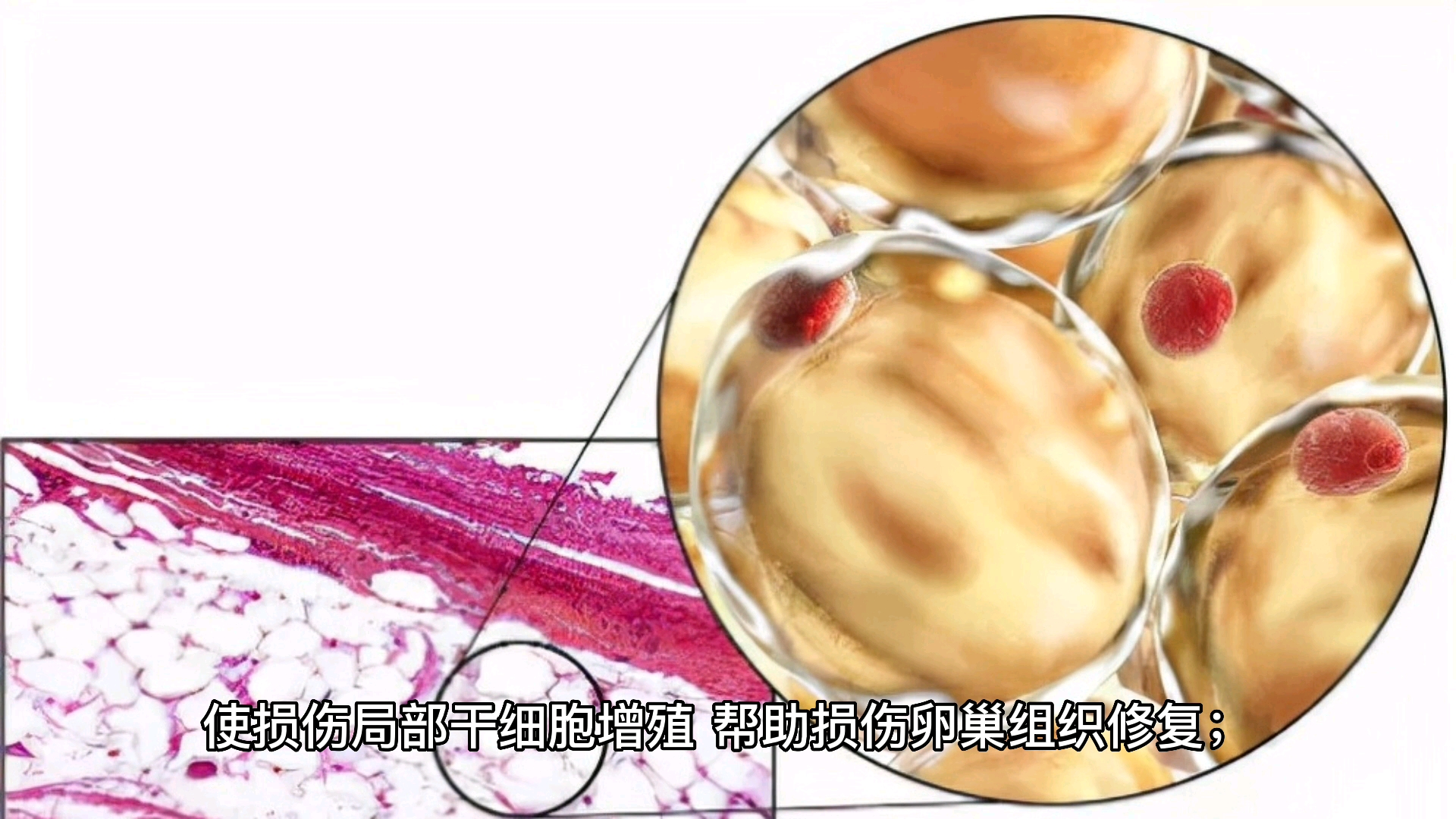 干细胞治疗卵巢早衰的作用机制