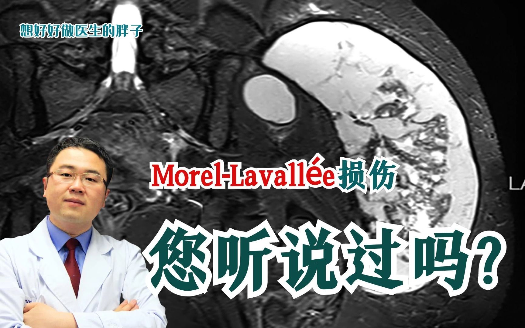 MorelLavall㩥损伤,常见但容易被忽视!医生和您好好聊一聊!哔哩哔哩bilibili