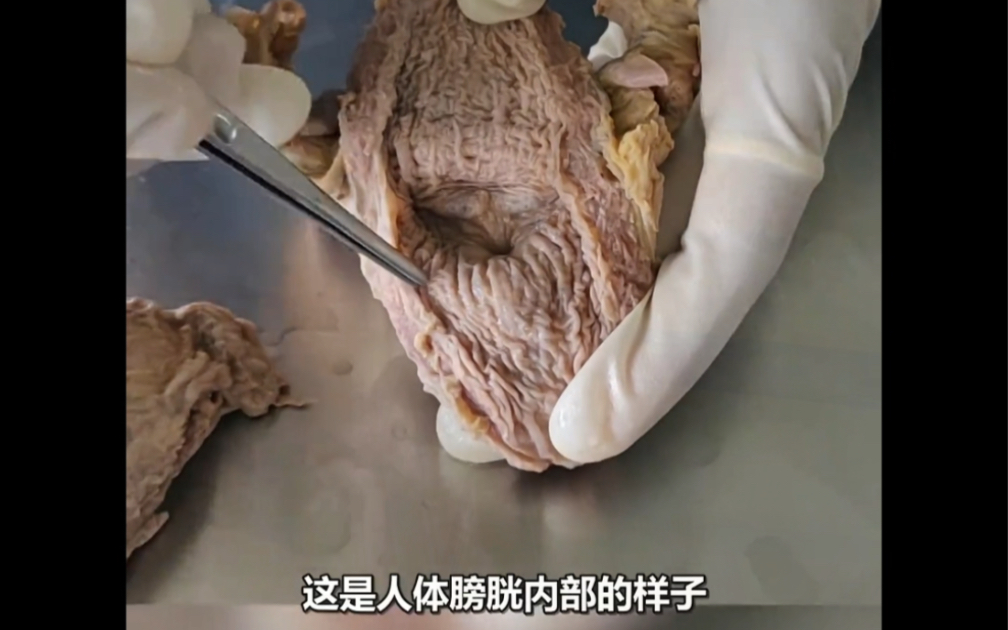 膀胱 #科普知识