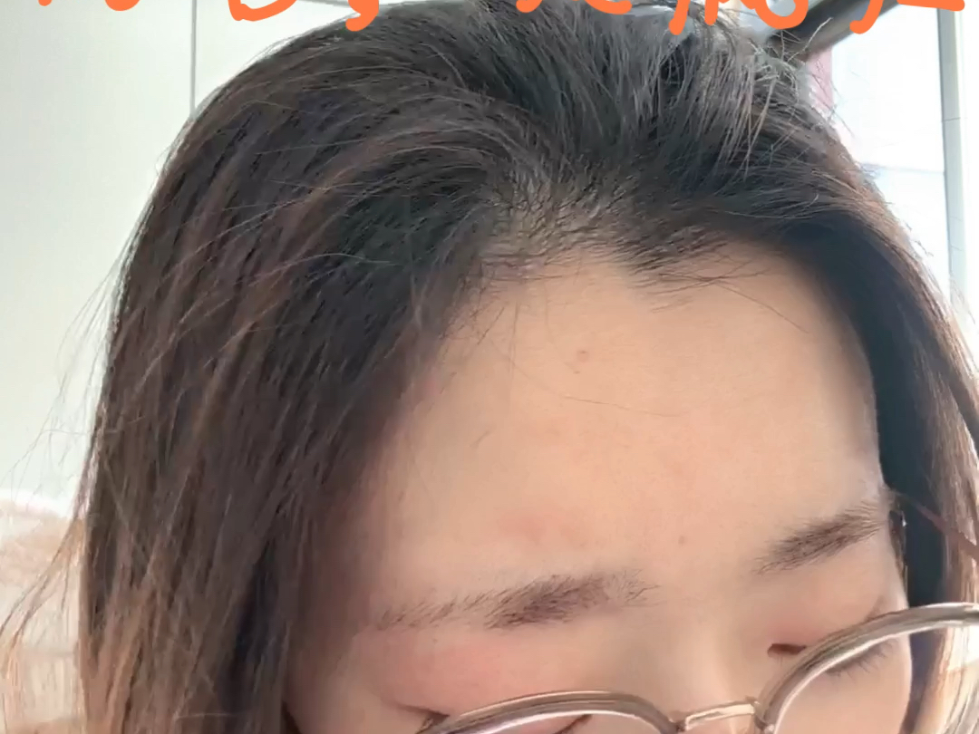 别管我啦,真是疯了(扶额苦笑)