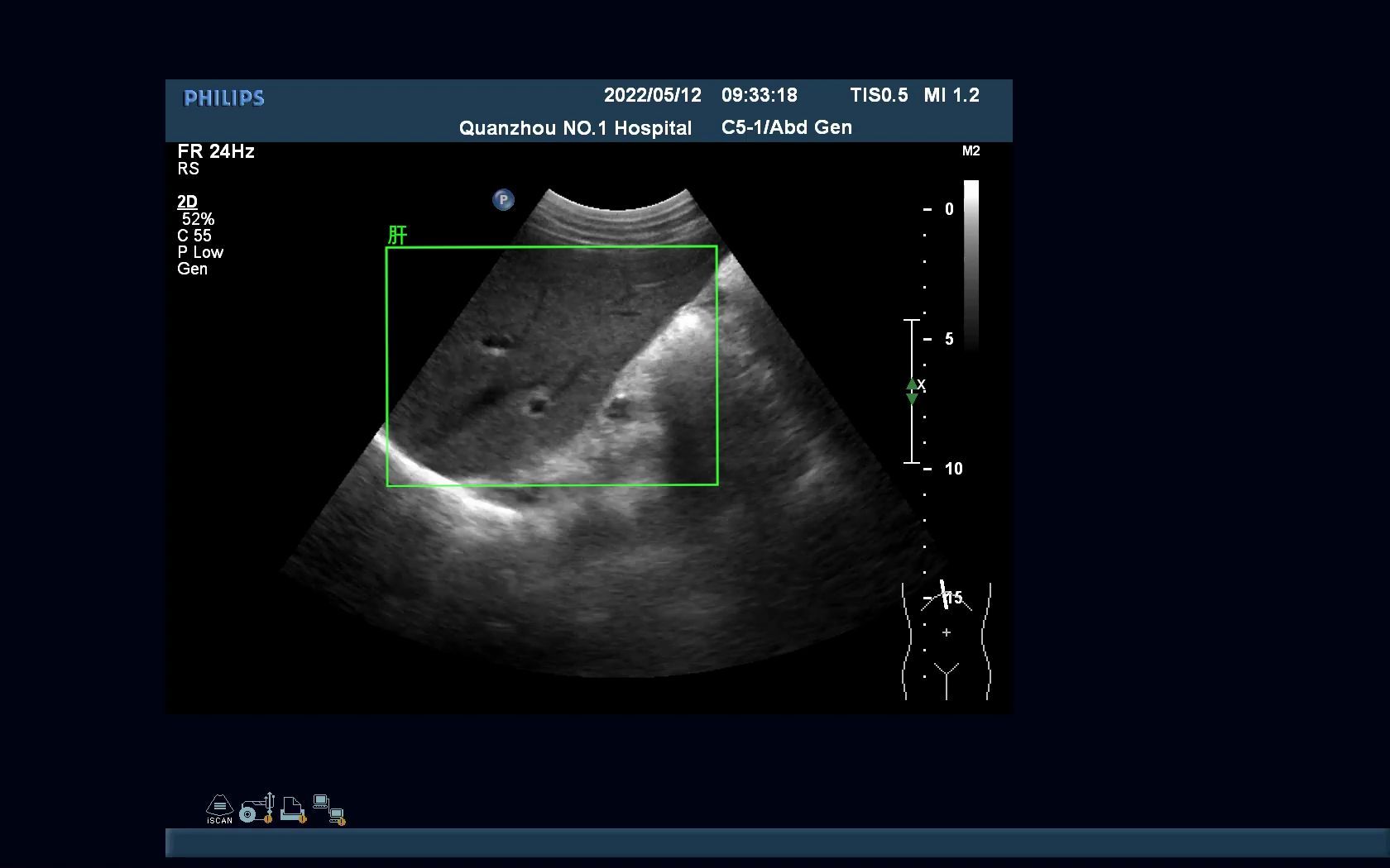 肝脏超声操作系统演示哔哩哔哩bilibili