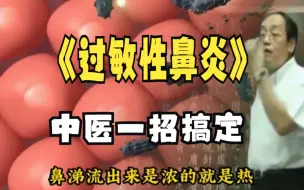 Tải video: 过敏性鼻炎一招搞定 鼻窦炎一招搞定