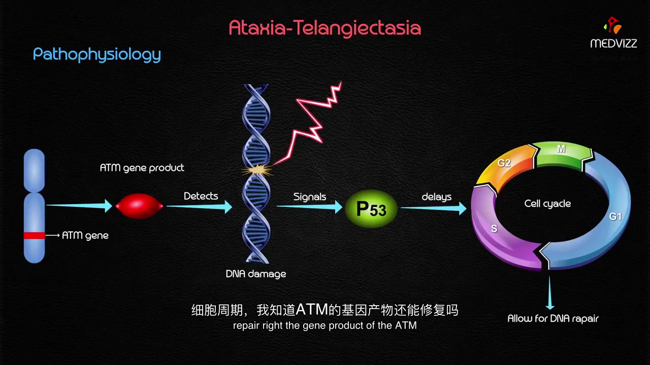 【中英字幕】共济失调毛细血管扩张综合征AtaxiaTelangiectasia SyndromeUsmle哔哩哔哩bilibili