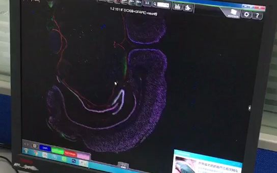 多色免疫荧光石蜡切片同源抗体三标(脑组织)哔哩哔哩bilibili