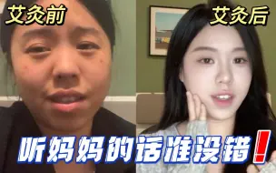 Download Video: 妈妈的爱太沉重了！不过这个明火艾灸还真挺好用的！