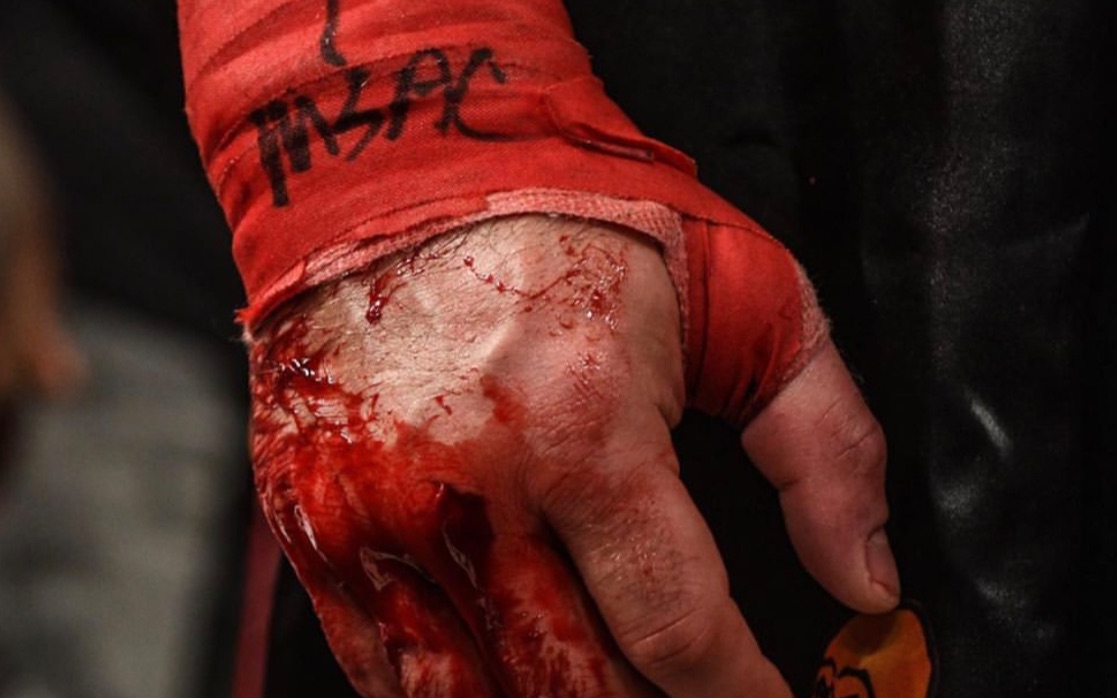 岩直有理#"拳拳彪血"的裸拳大赛纪录片