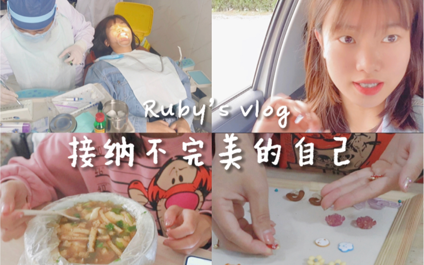 [图]#VlOG/接纳不完美的自己/24岁，我终于整牙了/摆摊准备