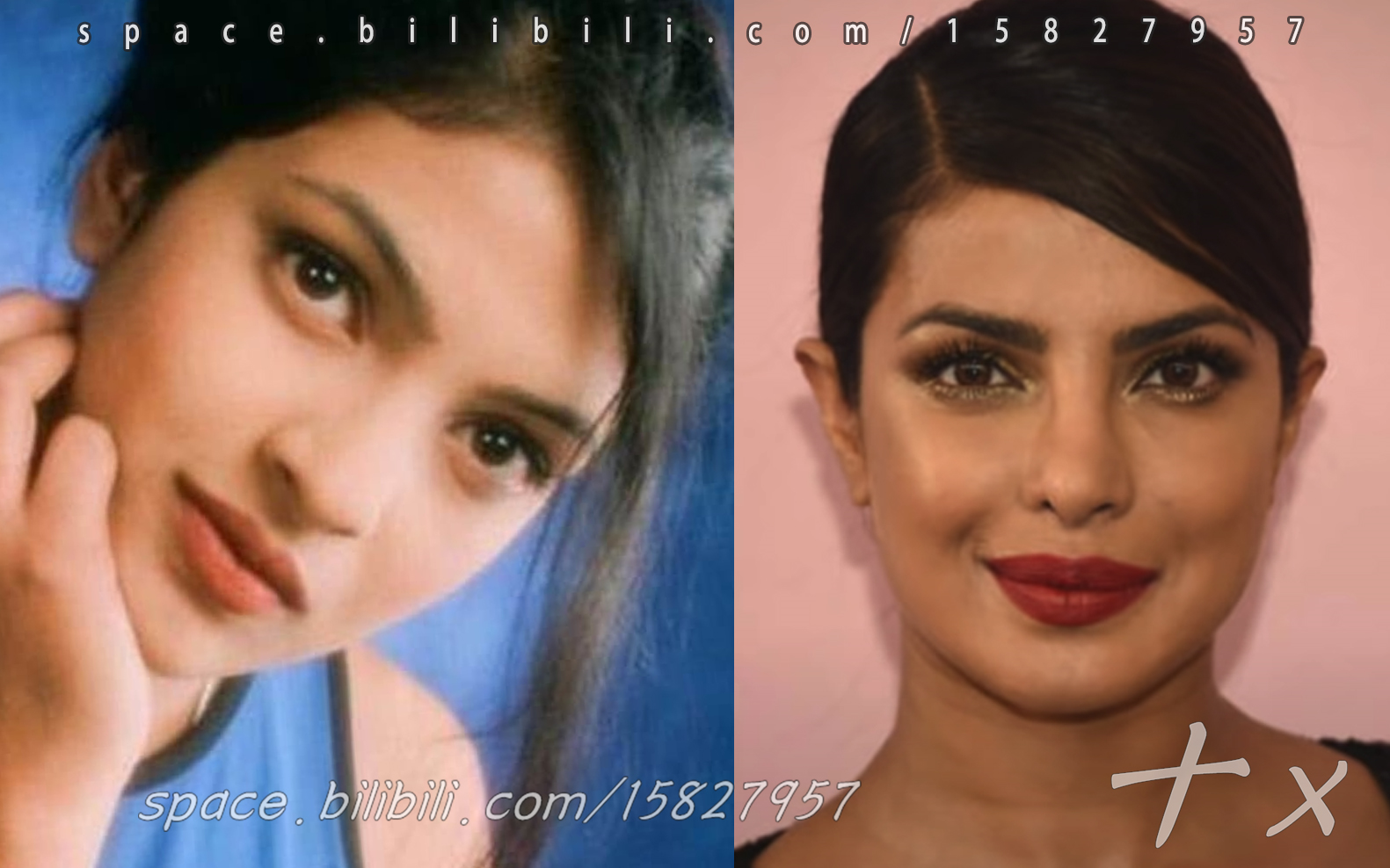 《选美冠军Priyanka整容史》宝莱坞女星环球小姐 | Priyanka Chopra; Plastic (Cosmetic ) Surgery 2020哔哩哔哩bilibili