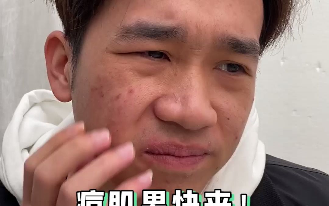 终于有人做了这件事!真的是在为00后痘肌男造福呀!