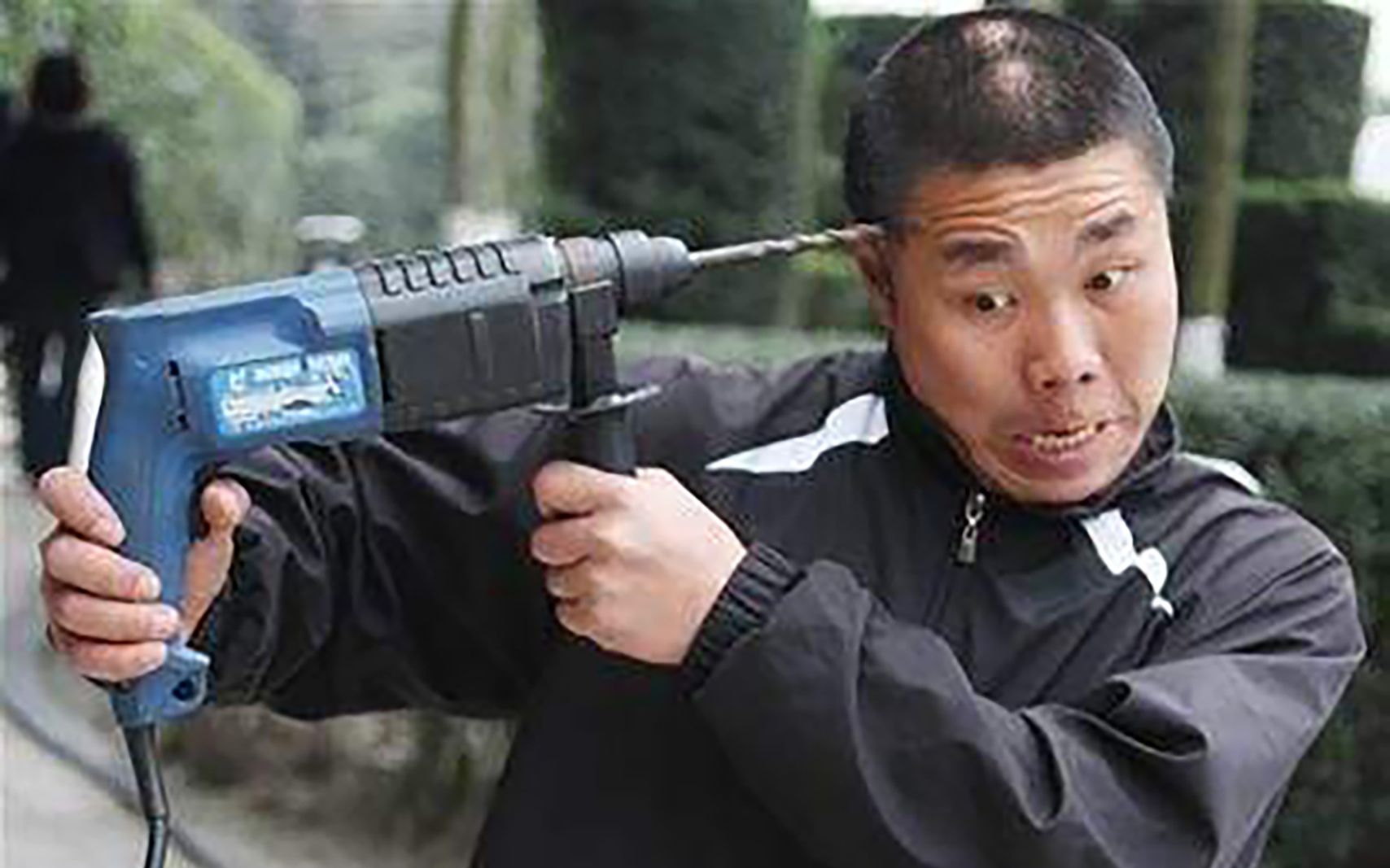 疯了!他竟敢用电钻钻脑袋,结果竟没事!