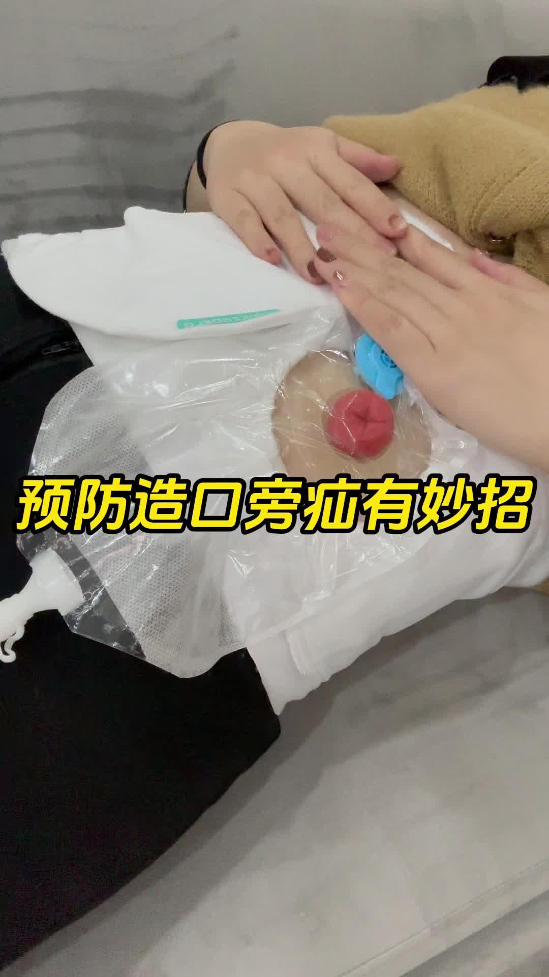 預防造口旁疝有妙招