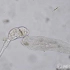 显微镜下的猎杀：纤毛虫吞噬轮虫2