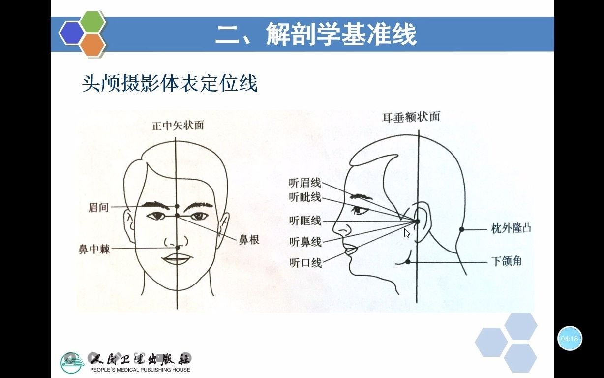 医学影像检查技术学X线检查技术哔哩哔哩bilibili