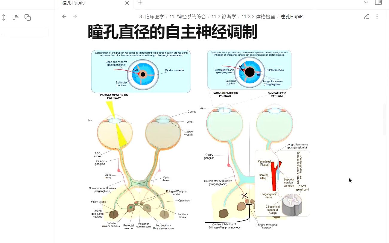 【神经重症】瞳孔Pupils哔哩哔哩bilibili