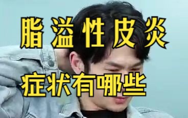 脂溢性皮炎的4种症状哔哩哔哩bilibili