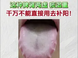 Download Video: 这种脾肾两虚，痰湿重，千万不能直接用去补阳！