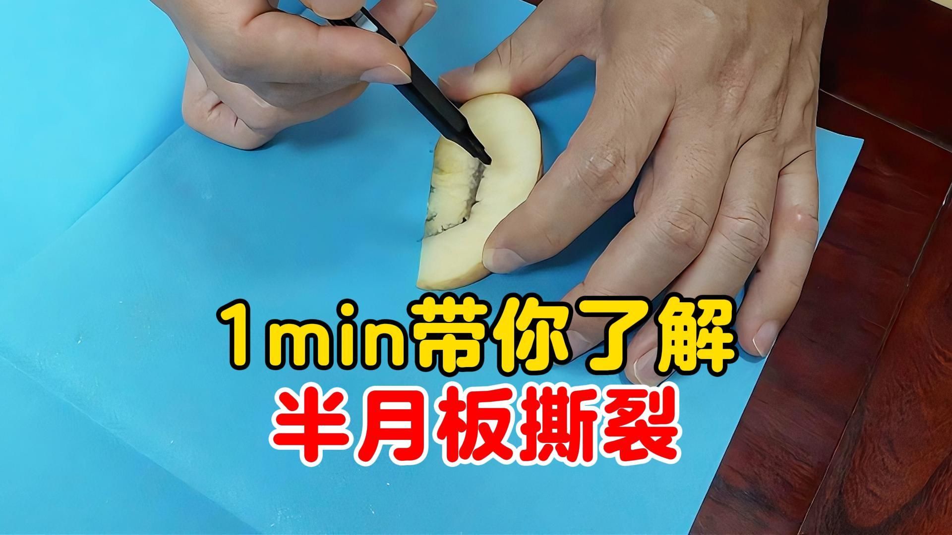 1min带你了解半月板撕裂
