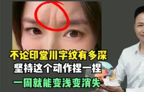 Tải video: 不论印堂川字纹有多深，每天坚持这个动作捏一捏，一周变浅变消失