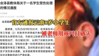 云南8岁小学生被老师用戒尺打破头，教体局：严肃处理涉事教师