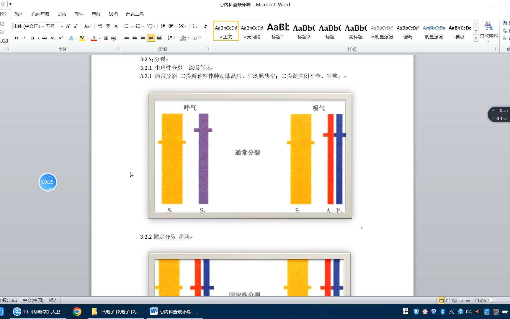 第二心音的分裂哔哩哔哩bilibili