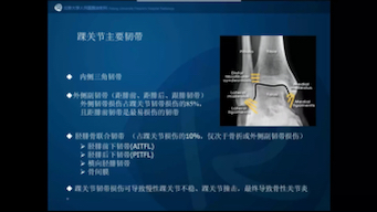 杜湘珂足踝关节常见病变影像诊断哔哩哔哩bilibili