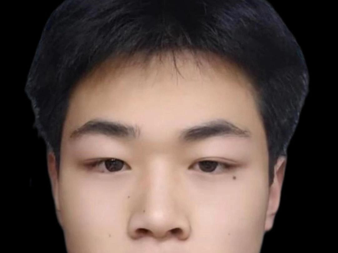 男人最怕"双破之相",这些痣,一定要去掉