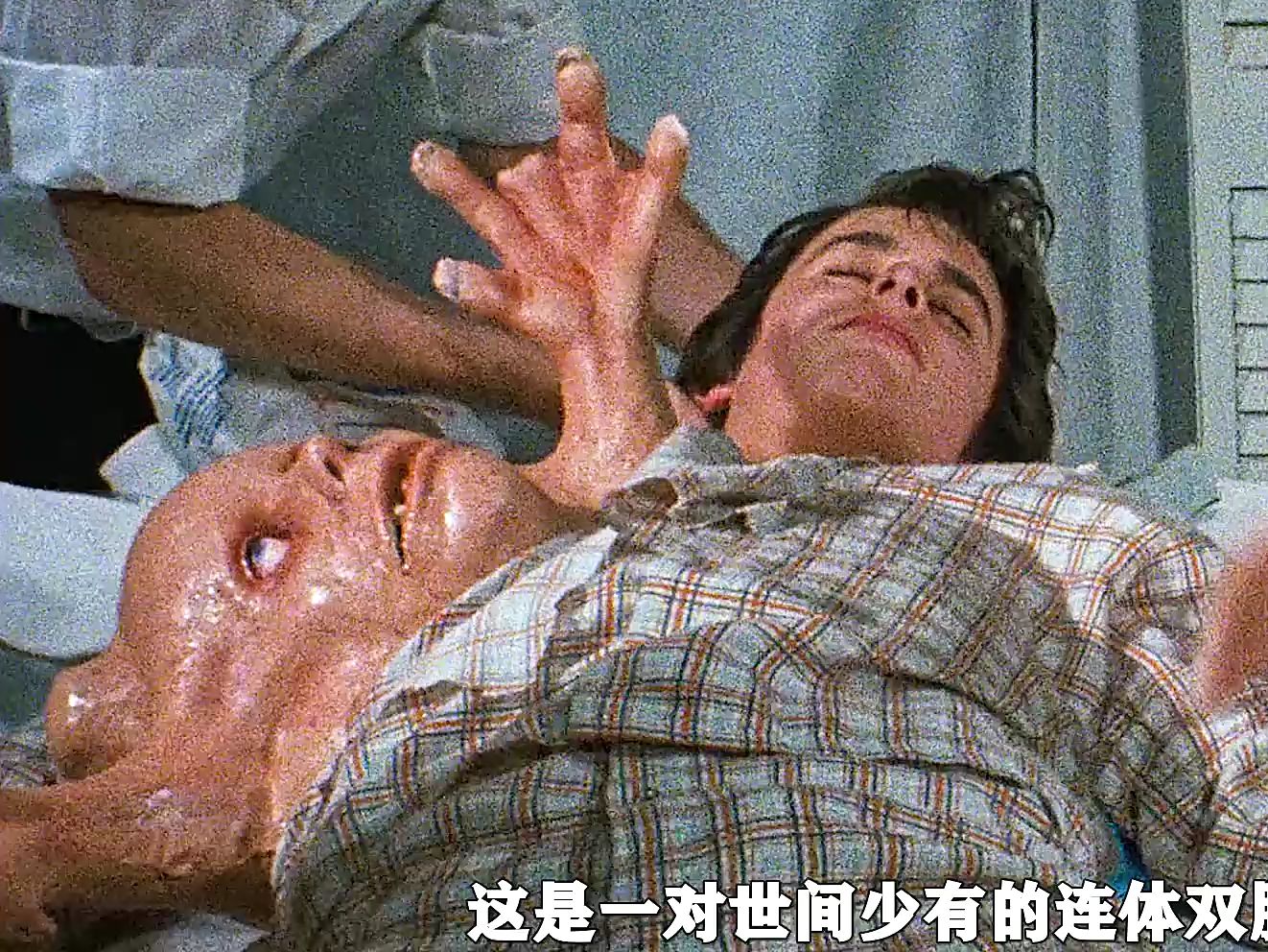 双胞胎的绝望哀啼