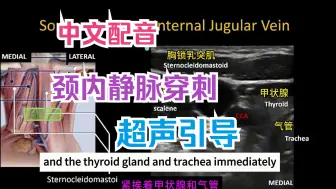 Tải video: 【麻醉技术】超声引导下颈内静脉穿刺置管 中文配音 双语字幕 翻译人工校对 部分图片翻译