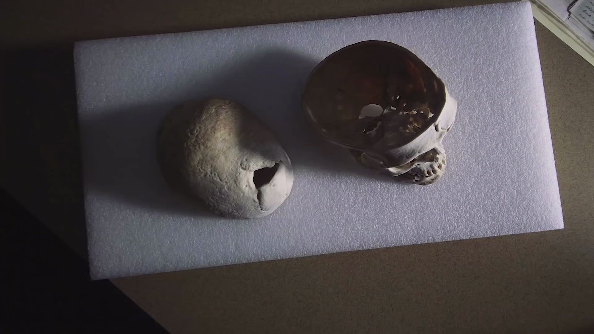 the phineas gage story