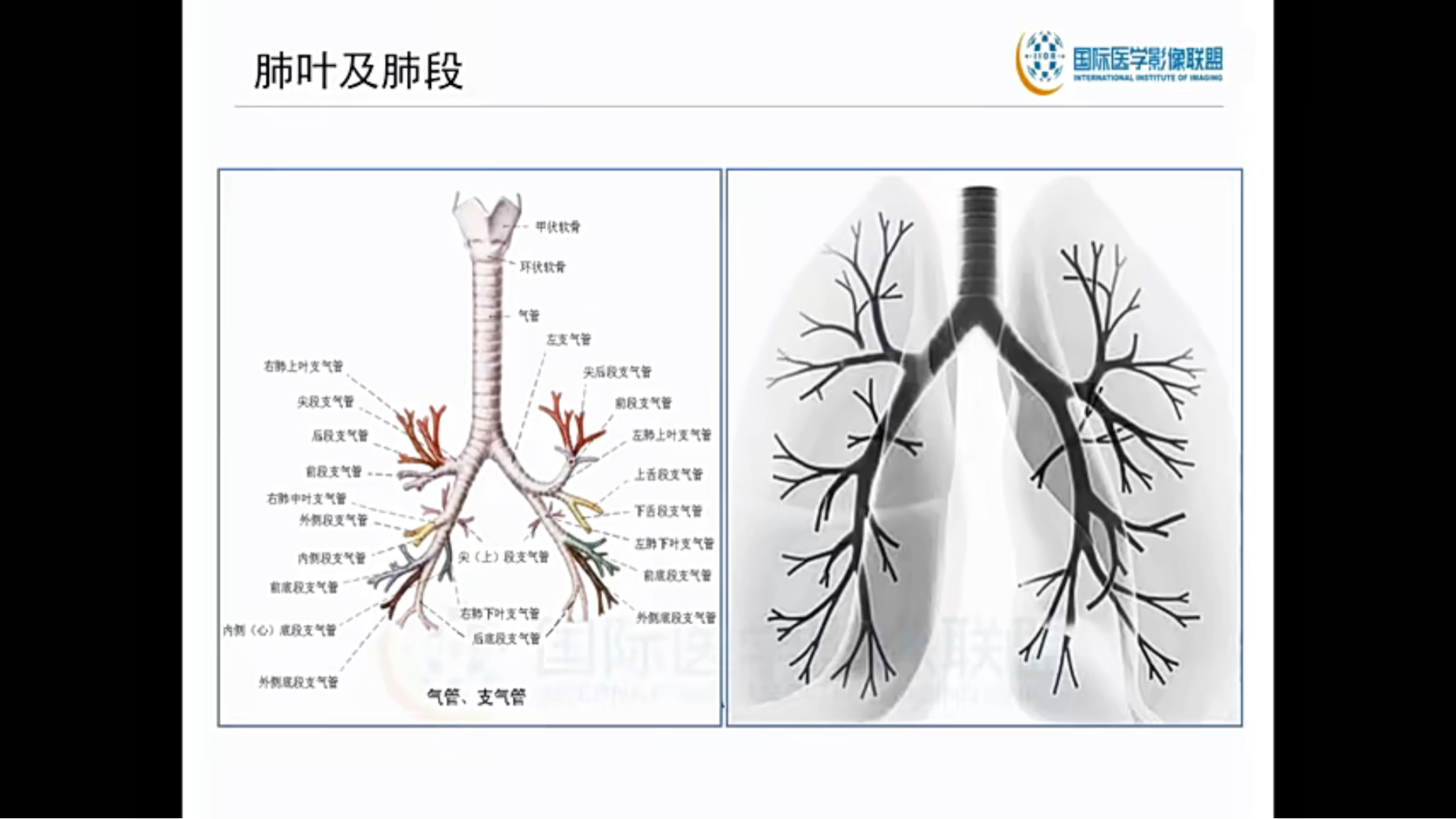 肺部影像基础(共30讲)02肺部常见病变的解剖及病理基础哔哩哔哩bilibili