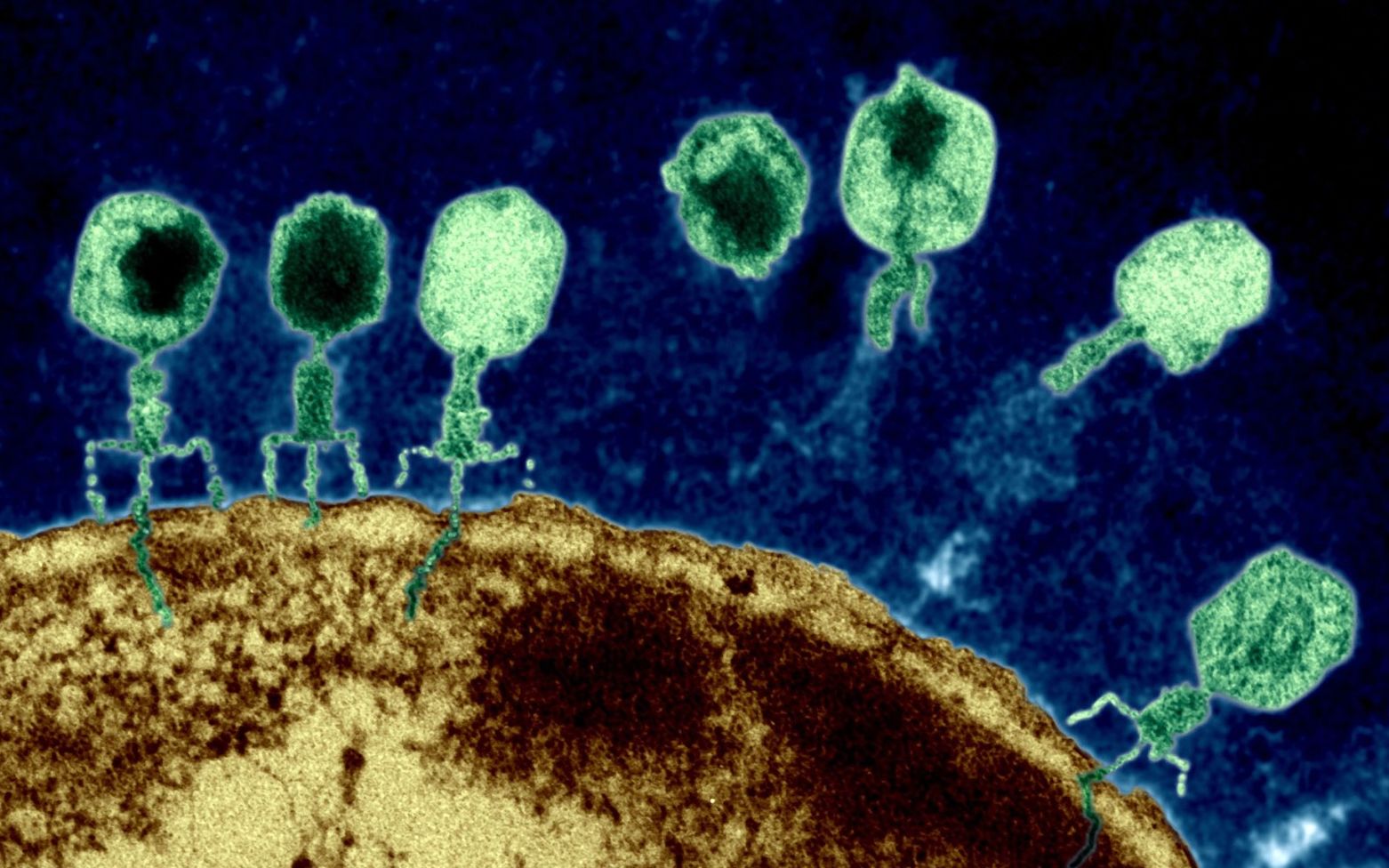 新冠病毒电镜图片图片